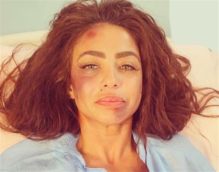 دوللي شاهين