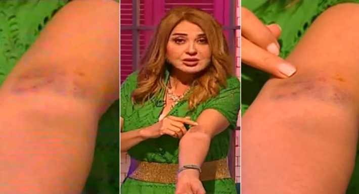 إصابة مادلين طبر