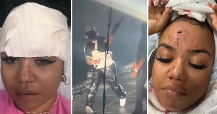 فيفتي سينت والفتاة المصابة