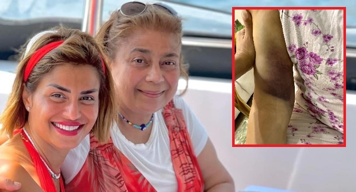 منة فضالي ووالدتها