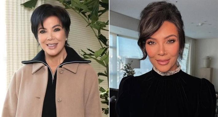 كريس جينر قبل وبعد التجميل