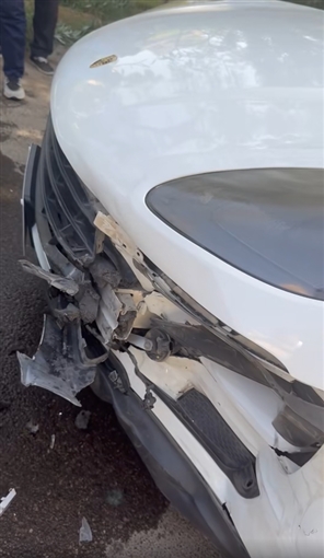 إصابة نجل ريم سامي ونقله للعناية المركزة إصابة نجل ريم سامي ونقله للعناية المركزة