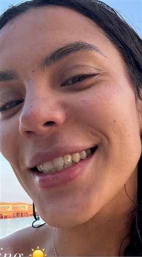 رومانسية هادي الباجوري وزوجته هايدي خالد في شهر العسل