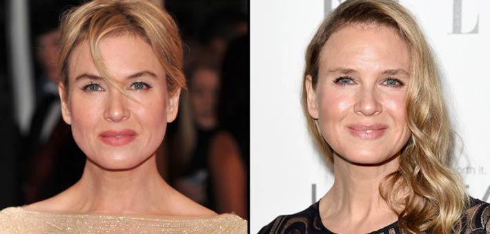 رينيه زيلويجر