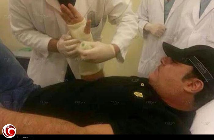 عاضي الحلاني يجبر يده المكسورة