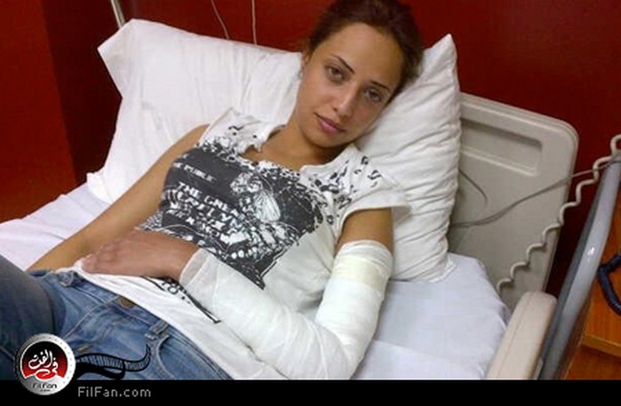 تمزق في يد راندا حافظ