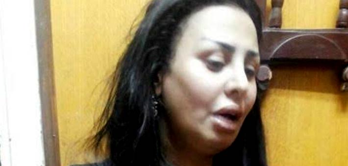 بطلة فيديو أغنية &quot;سيب إيدي&quot;