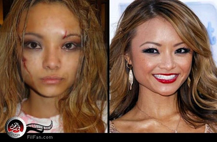 تيلا تيكيلا قبل وبعد الحادث