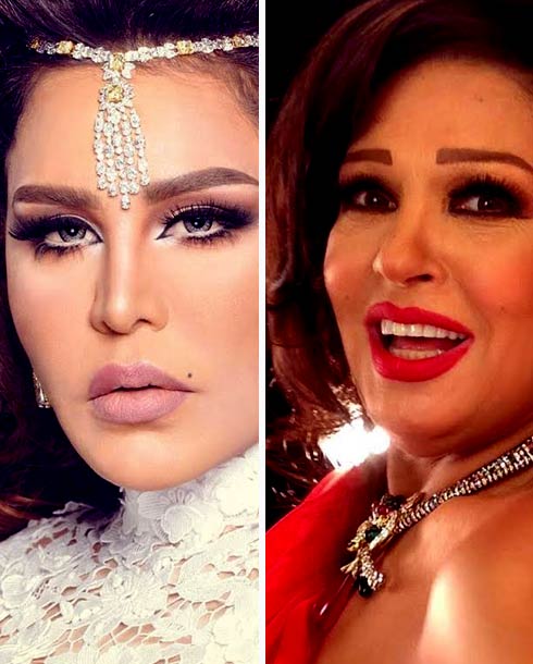 فيفي عبده وأحلام