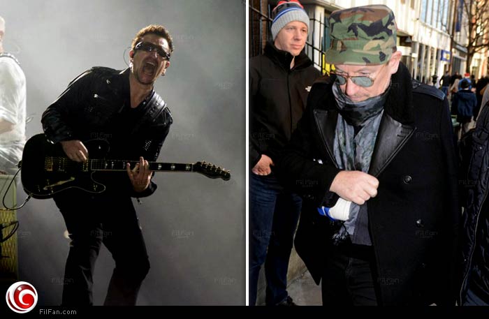 بونو قبل وبعد الإصابة