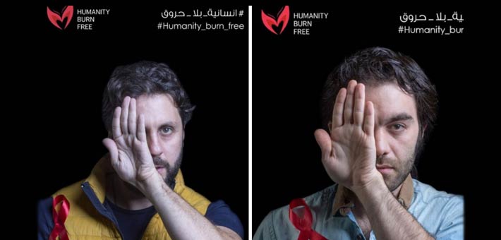 شريف رمزي وهشام ماجد من المبادرة