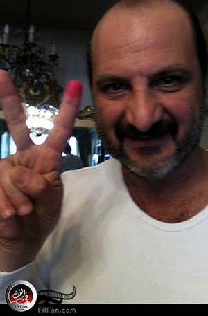 خالد الصاوي فخور بإصبعه 