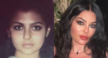 هيفاء وهبي قبل وبعد التجميل