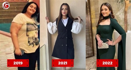 ملك أحمد زاهر قبل وبعد انقاص وزنها