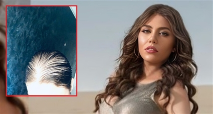 رحمة حسن ترفض اعتذار العيادة المتسببة في تساقط شعرها: مش مسمحاهم أبدا