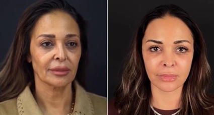 داليا البحيري