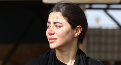 يارا السكري