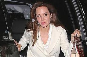 أنجيلينا جولي بعد تعرضها لحادث السيارة