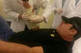 عاضي الحلاني يجبر يده المكسورة