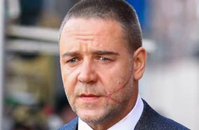 راسل كرو‎ بندبة كبيرة في وجهة