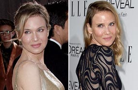 رينيه زيلويجر كما نعرفها في أوسكار 2013 على اليسار مقابل رينيه بوجهها الجديد على اليمين