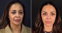 داليا البحيري